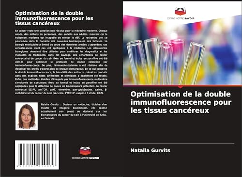 Optimisation de la double immunofluorescence pour les tissus cancéreux von Editions Notre Savoir