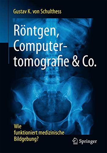 Röntgen, Computertomografie & Co.: Wie funktioniert medizinische Bildgebung? von Springer