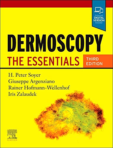 Dermoscopy: The Essentials Dermoscopy: The Essentials von Elsevier