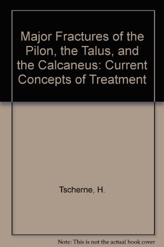 Major Fractures of the Pilon, the Talus, and the Calcaneus: Current Concepts of Treatment Major Fractures of the Pilon, the Talus, and the Calcaneus: Current Concepts of Treatment von Springer Verlag