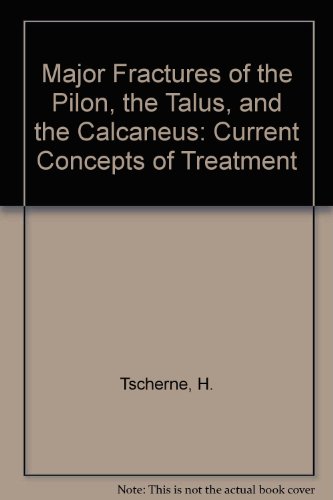 Major Fractures of the Pilon, the Talus, and the Calcaneus: Current Concepts of Treatment