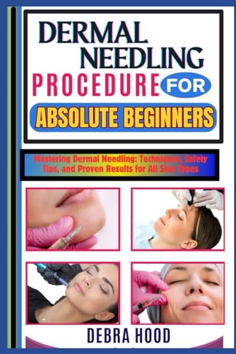 DERMAL NEEDLING PROCEDURE: Mastering Dermal Needling: Techniques, Safety Tips, and Proven Results for All Skin Types von Independently published