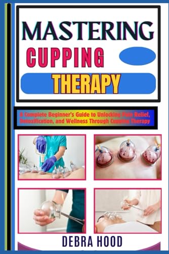 MASTERING CUPPING THERAPY: A Complete Beginner’s Guide to Unlocking Pain Relief, Detoxification, and Wellness Through Cupping Therapy von Independently published