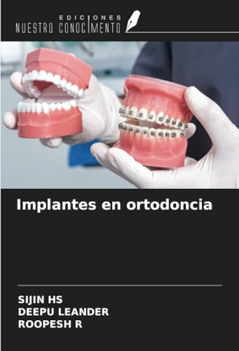 Implantes en ortodoncia von Ediciones Nuestro Conocimiento