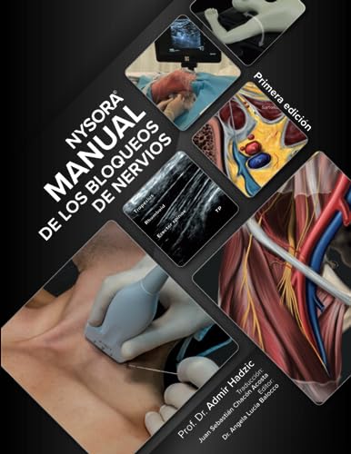 NYSORA Manual de los Bloqueos de Nervios: Primera Edición NYSORA Manual de los Bloqueos de Nervios: Primera Edición von NYSORA, Inc