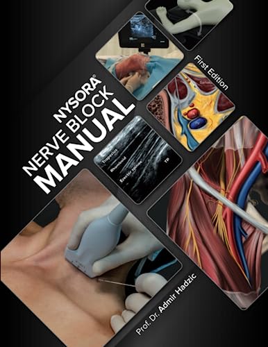 NYSORA Nerve Block Manual: First Edition NYSORA Nerve Block Manual: First Edition