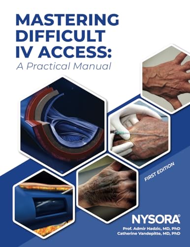 Mastering Difficult IV Access - a Practical Manual: First Edition Mastering Difficult IV Access - a Practical Manual: First Edition