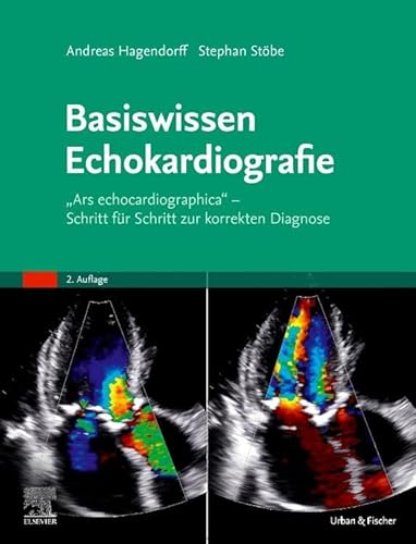 Basiswissen Echokardiografie: "Ars echocardiographica" - Schritt für Schritt zur korrekten Diagnose von Urban & Fischer Verlag/Elsevier GmbH