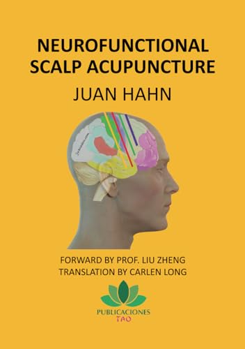Neurofunctional scalp acupuncture von Independently published