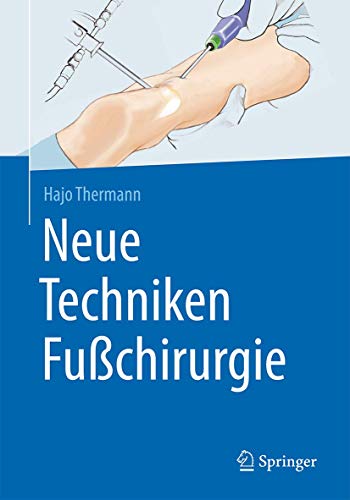 Neue Techniken Fußchirurgie von Springer