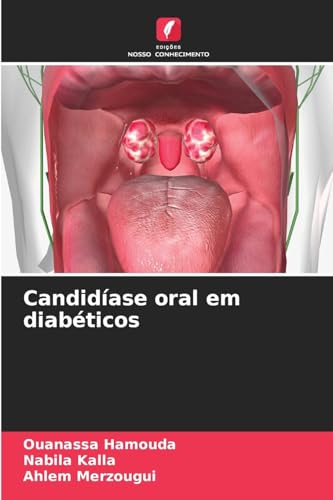 Candidíase oral em diabéticos von Edições Nosso Conhecimento