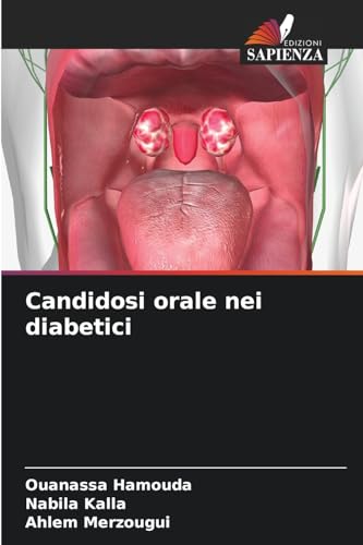 Candidosi orale nei diabetici von Edizioni Sapienza