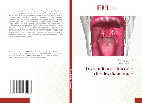 Les candidoses buccales chez les diabétiques: DE von Éditions universitaires européennes