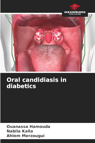 Oral candidiasis in diabetics von Our Knowledge Publishing