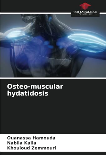 Osteo-muscular hydatidosis: DE von Our Knowledge Publishing