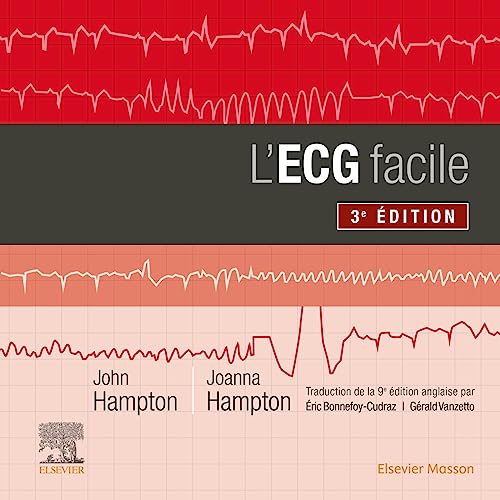 L'ECG facile