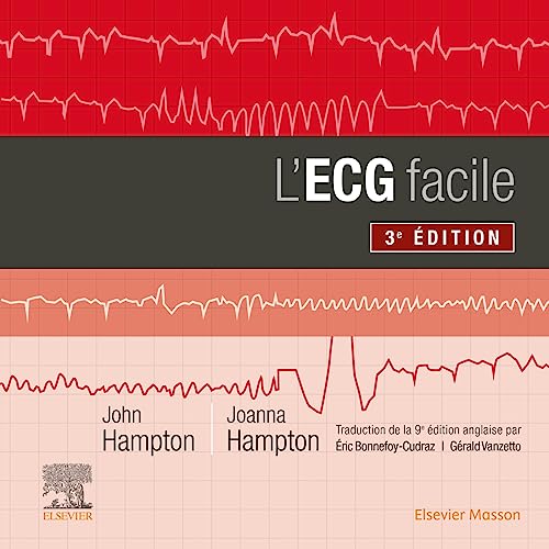 L'ECG facile von Elsevier Masson