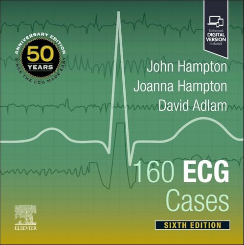 160 ECG Cases von Elsevier