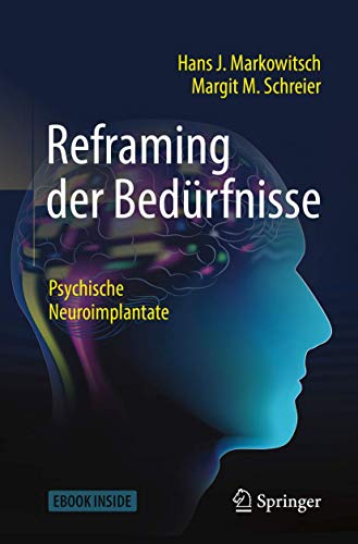 Reframing der Bedürfnisse: Psychische Neuroimplantate von Springer
