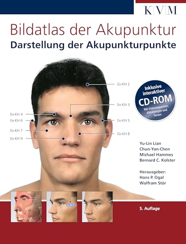 Bildatlas der Akupunktur: Darstellung der Akupunkturpunkte (inkl. CD-ROM)