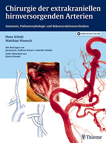 Chirurgie der extrakraniellen hirnversorgenden Arterien: Anatomie, Pathomorphologie und Rekonstruktionstechniken. Plus Online-Version in der eRef