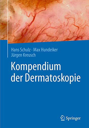 Kompendium der Dermatoskopie von Springer