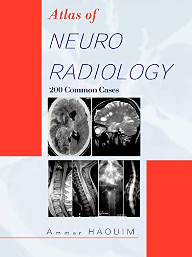 Atlas of Neuroradiology: 200 Common Cases von Trafford Publishing