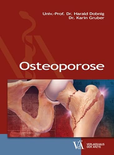 Osteoporose von Verlagshaus der rzte