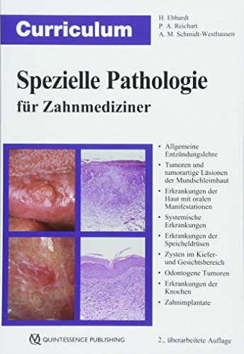 Curriculum Spezielle Pathologie für Zahnmediziner (Curriculum Zahnmedizin): Allgemeine Entzündungslehre, Tumoren und tumorartige Läsionen der ... und Gesichtsbereich, Odontogene Tumoren, E... von Quintessenz Verlags-GmbH