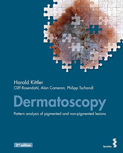 Dermatoscopy: An algorithmic method based on pattern analysis