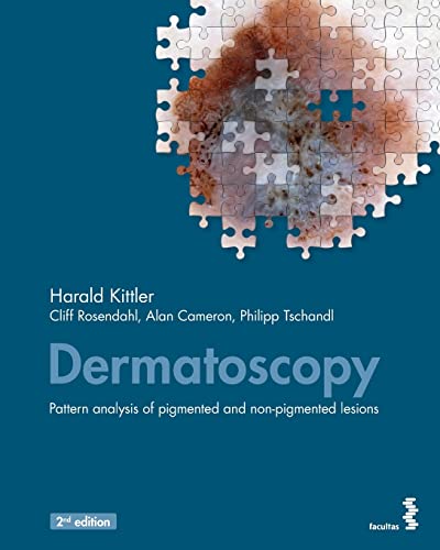 Dermatoscopy: An algorithmic method based on pattern analysis Dermatoscopy: An algorithmic method based on pattern analysis