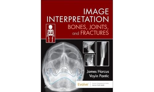 Image Interpretation: Bones, Joints, and Fractures (Evolve: Student Resources) von Elsevier