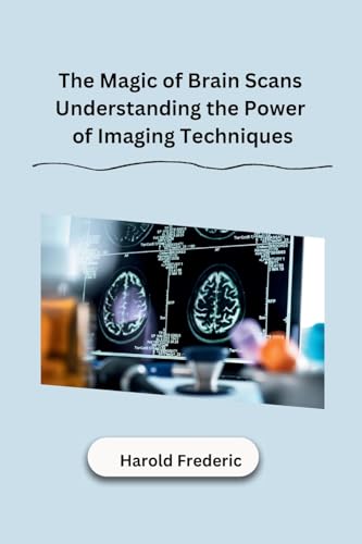 The Magic of Brain Scans Understanding the Power of Imaging Techniques von Self