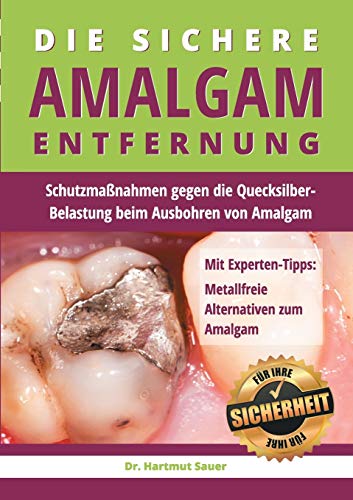 Die sichere Amalgam-Entfernung: Schutzmaßnahmen gegen die Quecksilber-Belastung beim Ausbohren von Amalgam