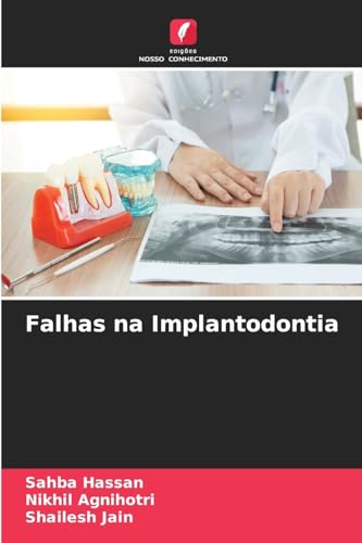 Falhas na Implantodontia: DE von Edições Nosso Conhecimento