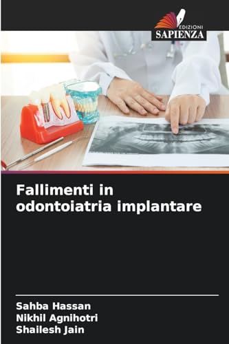 Fallimenti in odontoiatria implantare: DE von Edizioni Sapienza