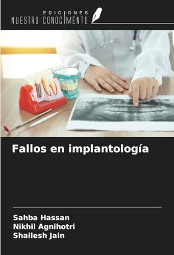 Fallos en implantología von Ediciones Nuestro Conocimiento