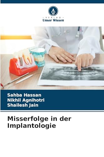 Misserfolge in der Implantologie von Verlag Unser Wissen