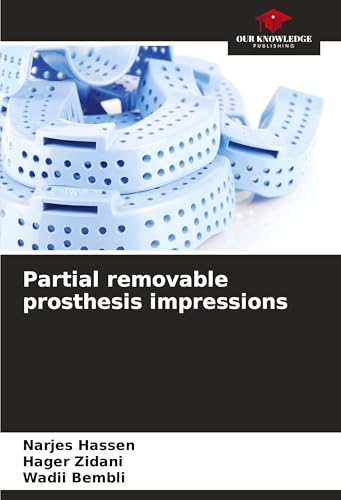 Partial removable prosthesis impressions: DE von Our Knowledge Publishing