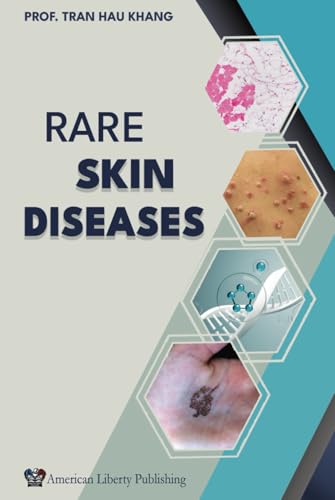 Rare Skin Diseases von American Liberty Publishing