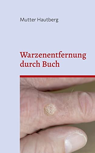 Warzenentfernung durch Buch: Heilung durch gespeicherte uralte BesprechEnergie