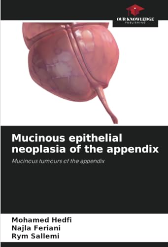 Mucinous epithelial neoplasia of the appendix: Mucinous tumours of the appendix von Our Knowledge Publishing