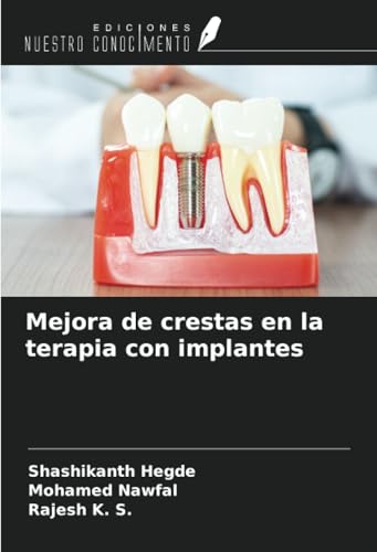 Mejora de crestas en la terapia con implantes von Ediciones Nuestro Conocimiento