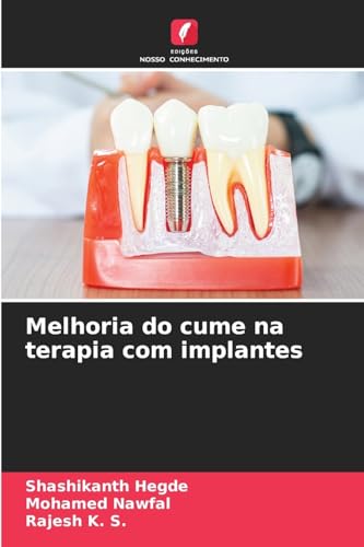 Melhoria do cume na terapia com implantes: DE von Edições Nosso Conhecimento