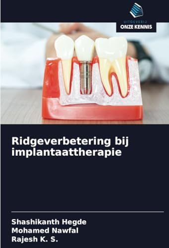 Ridgeverbetering bij implantaattherapie: DE von Uitgeverij Onze Kennis