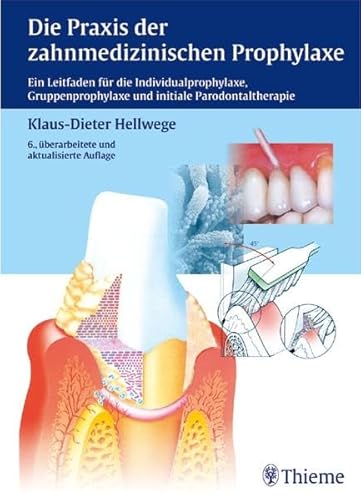 Die Praxis der zahnmedizinischen Prophylaxe: Ein Leitfaden f. d. Individual-, Gruppenprophylaxe u. initiale Parodontaltherapi: Ein Leitfaden für die ... und initiale Parodontaltherapie (ZMK Praxis)