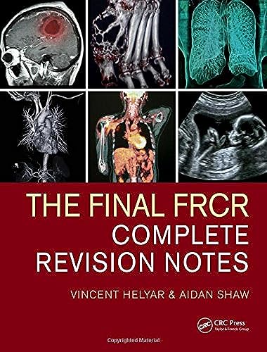 The Final FRCR: Complete Revision Notes von CRC Press