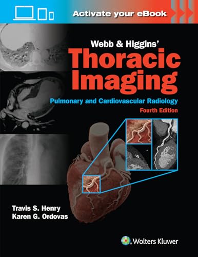Webb & Higgins Thoracic Imaging: Print + eBook with Multimedia von Lippincott Williams&Wilki