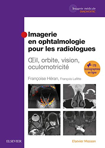 Imagerie en ophtalmologie pour les radiologues: Oeil, orbite, vision, oculomotricité von Elsevier Masson