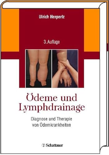 Ödeme und Lymphdrainage: Diagnose und Therapie von Ödemkrankheiten